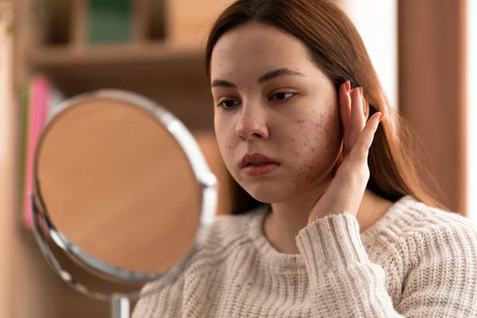 🧠💥 Your boss, your ex, and your skin: the toxic trio ruining your face