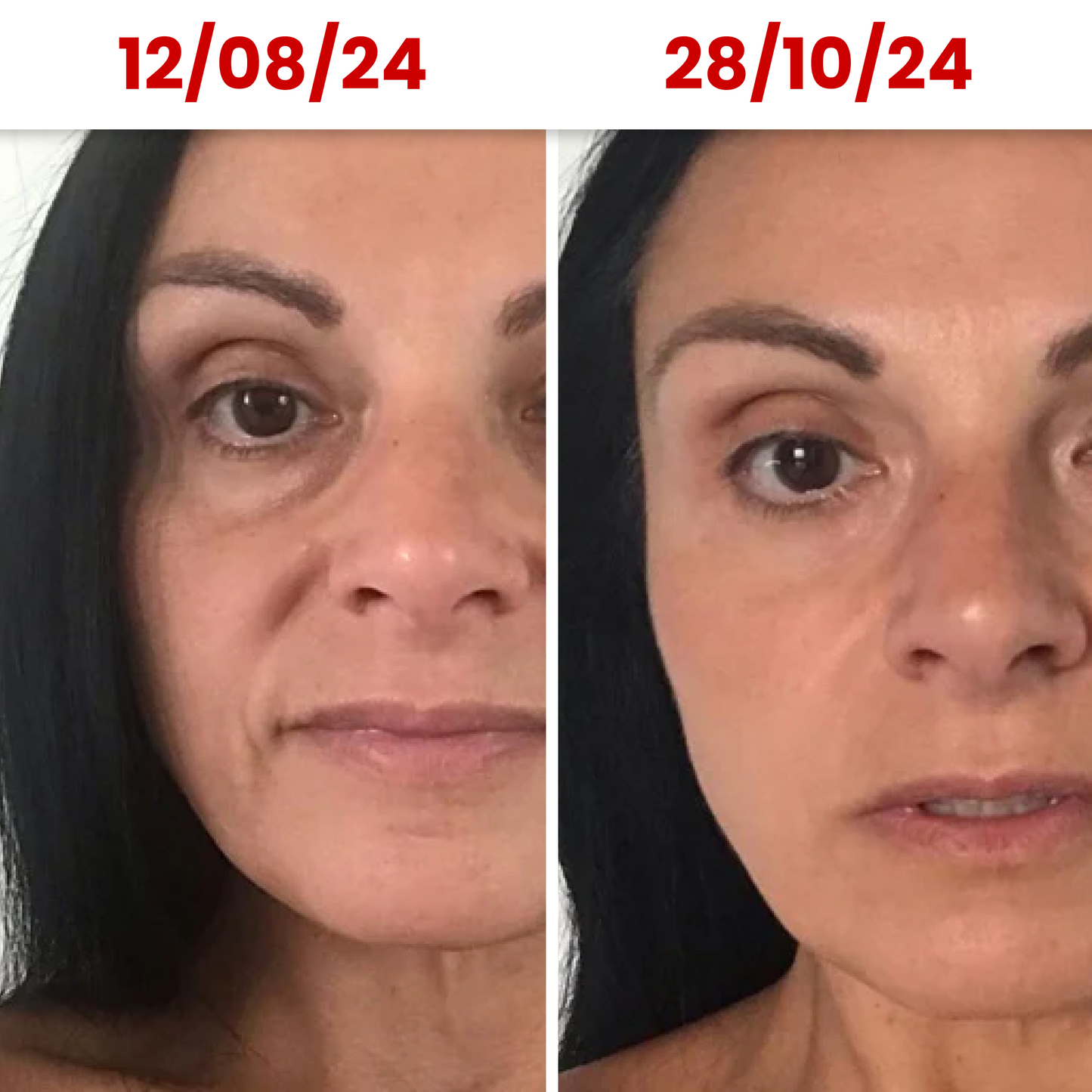 HydraGlow® Deep Face Mask