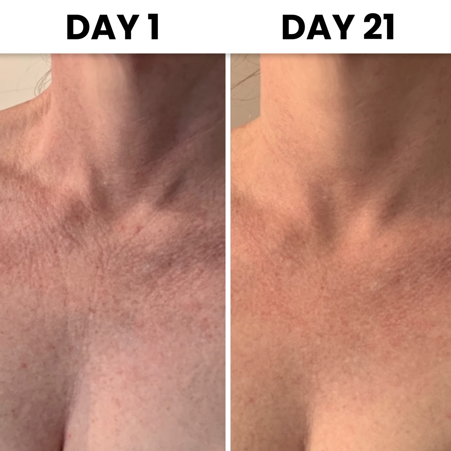 HydraGlow® Deep Décolleté Mask