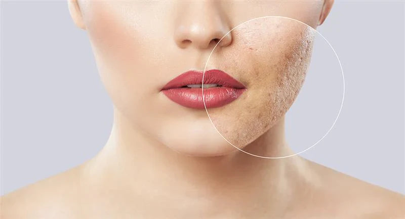 Let Your Skin Speak: How to Know Which Mask Your Face Needs