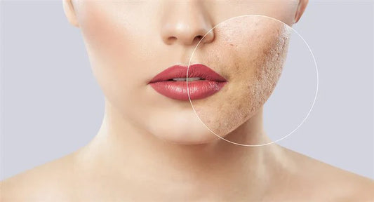 Let Your Skin Speak: How to Know Which Mask Your Face Needs