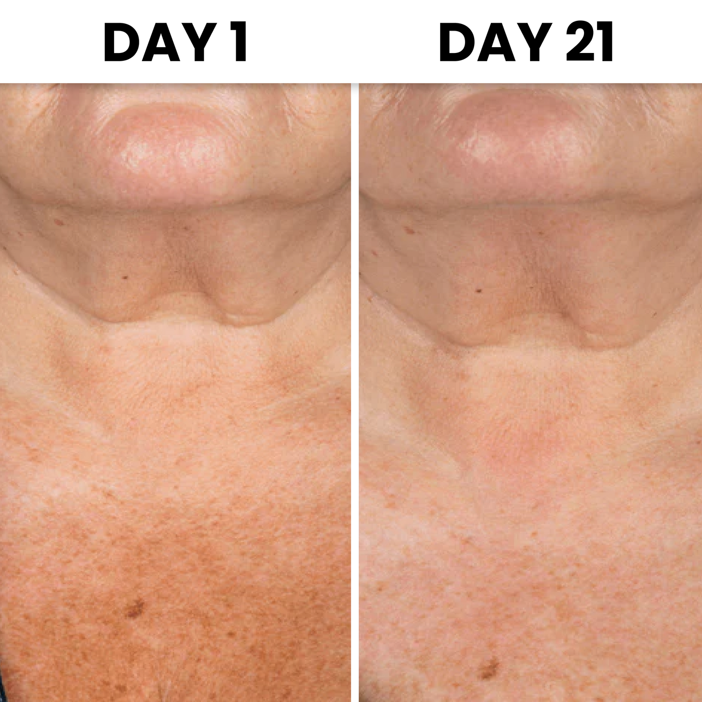 HydraGlow® Deep Décolleté Mask