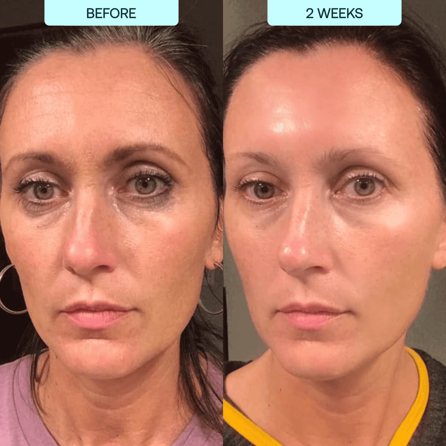 InstaGlow® Total Radiance Set