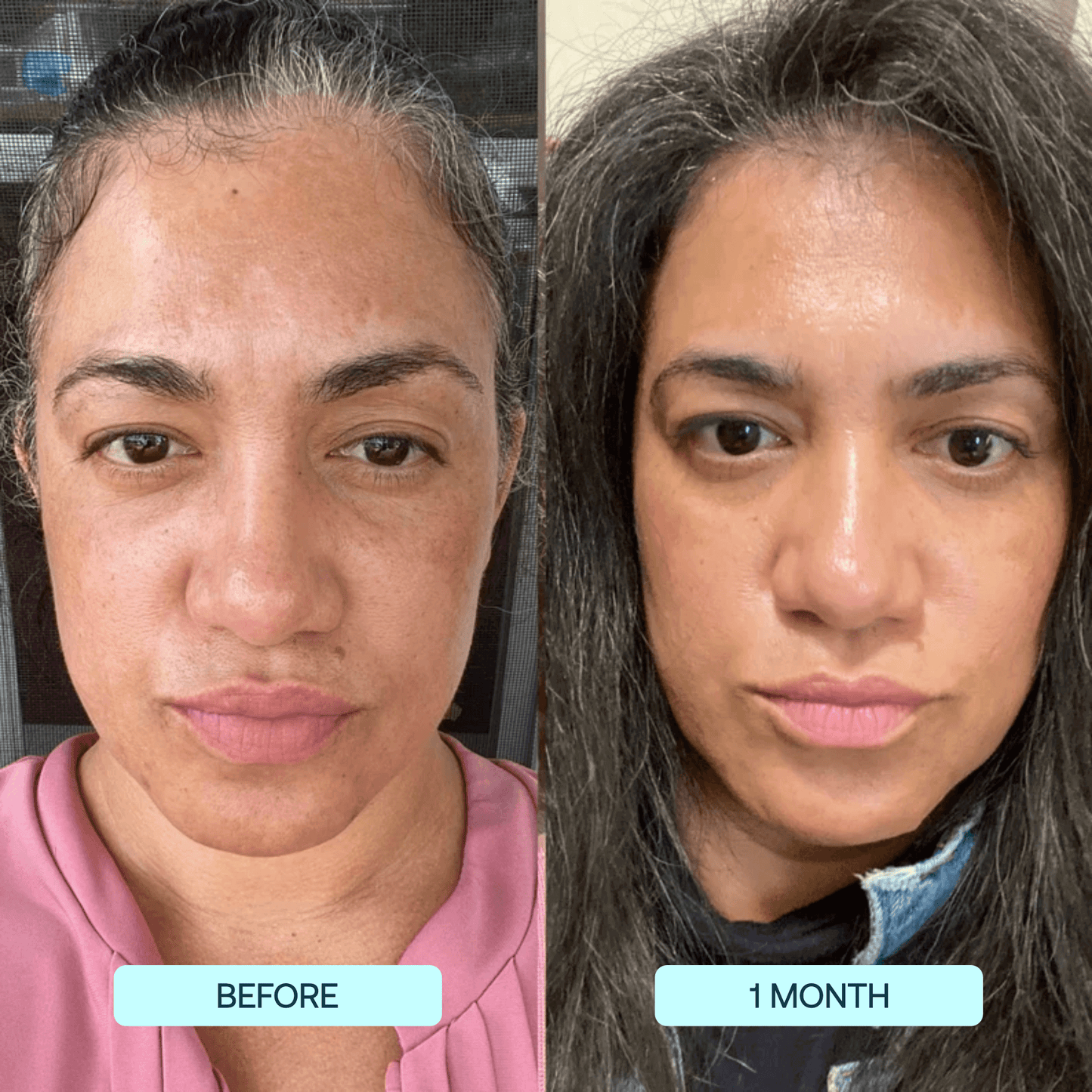 InstaGlow® Total Radiance Set