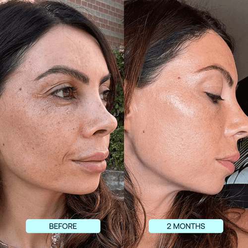 InstaGlow® Total Radiance Set